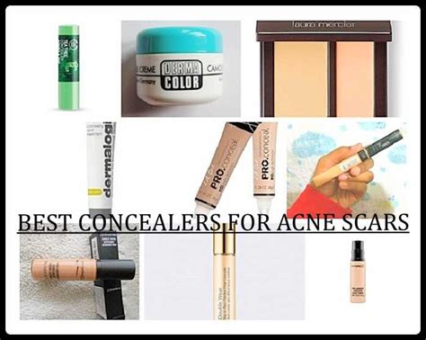 best concealer for acne scars and blemishes.